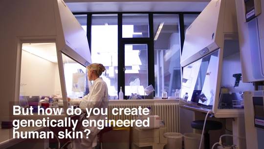 Genetically engineered human skin